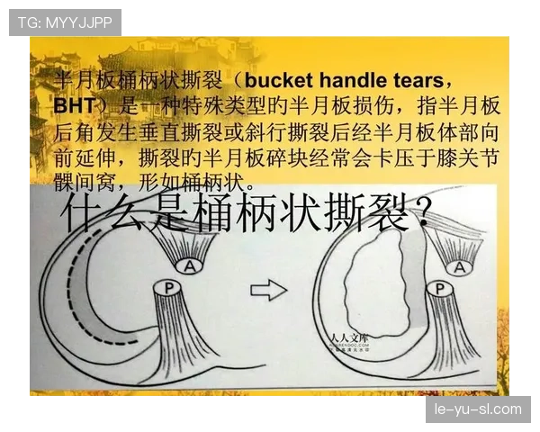 内马尔半月板撕裂详情